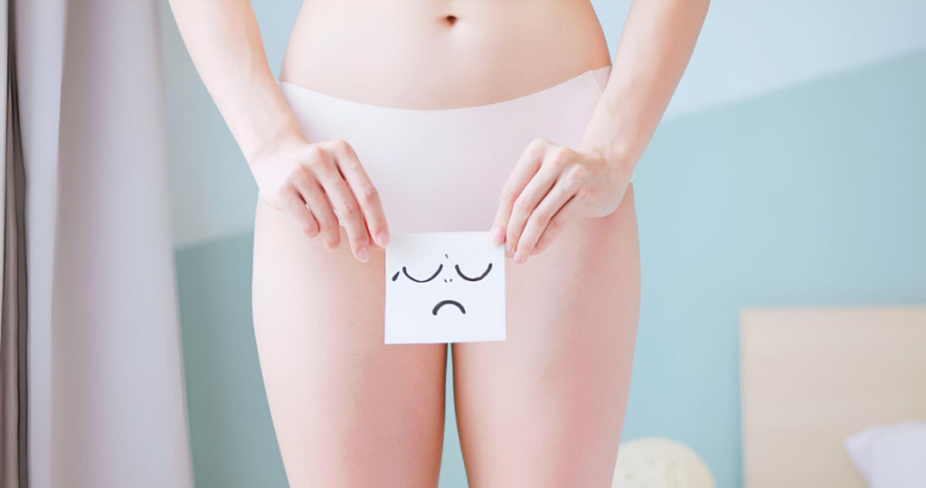 Vaginal discharge - Image