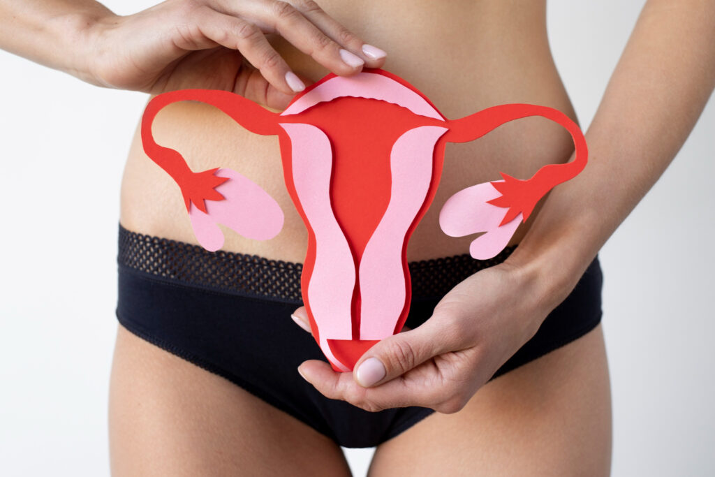 An ovarian cyst image
